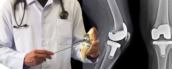 Chirurgien orthopédiste